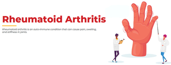 All about Rheumatoid Arthritis – Causes, Symptoms, Diagnosis, Treatment & Recommended Diet